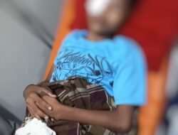 Remaja di Gowa Jadi Korban Tembakan Peluru Jeli, Mata Terluka Parah
